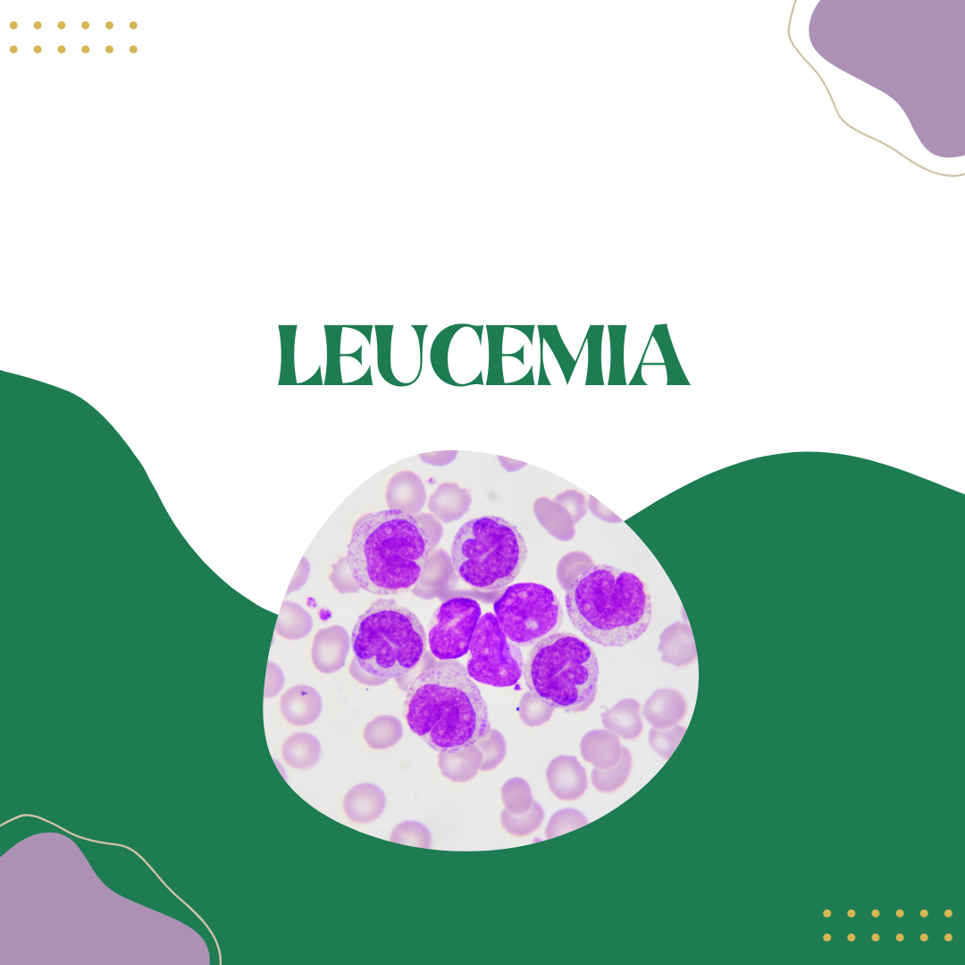 Quais São Os Tipos De Leucemia Cursau Educação Blog