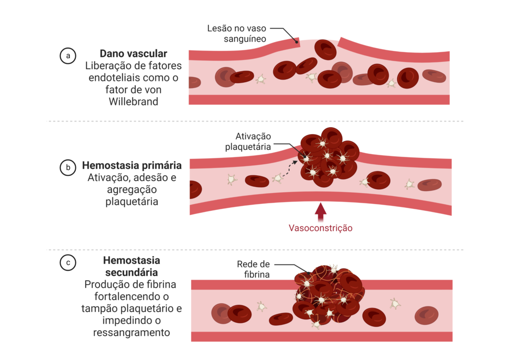 a imagem mostra de forma clara o que é hemostasia, destacando cada uma das fases e os principais eventos de cada fase