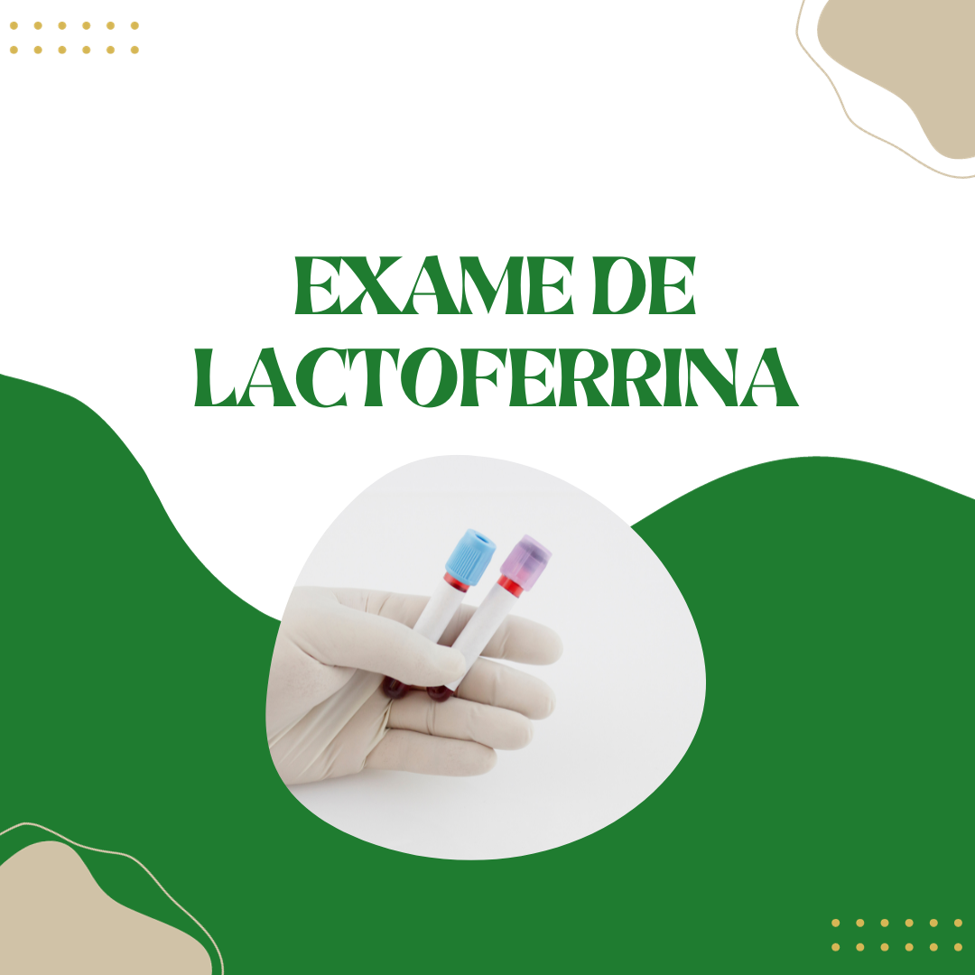 Para Que Serve O Exame De Lactoferrina Cursau Educa O Blog