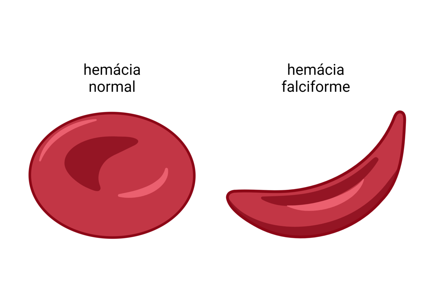 O que é anemia falciforme? - Cursau Educação - Blog