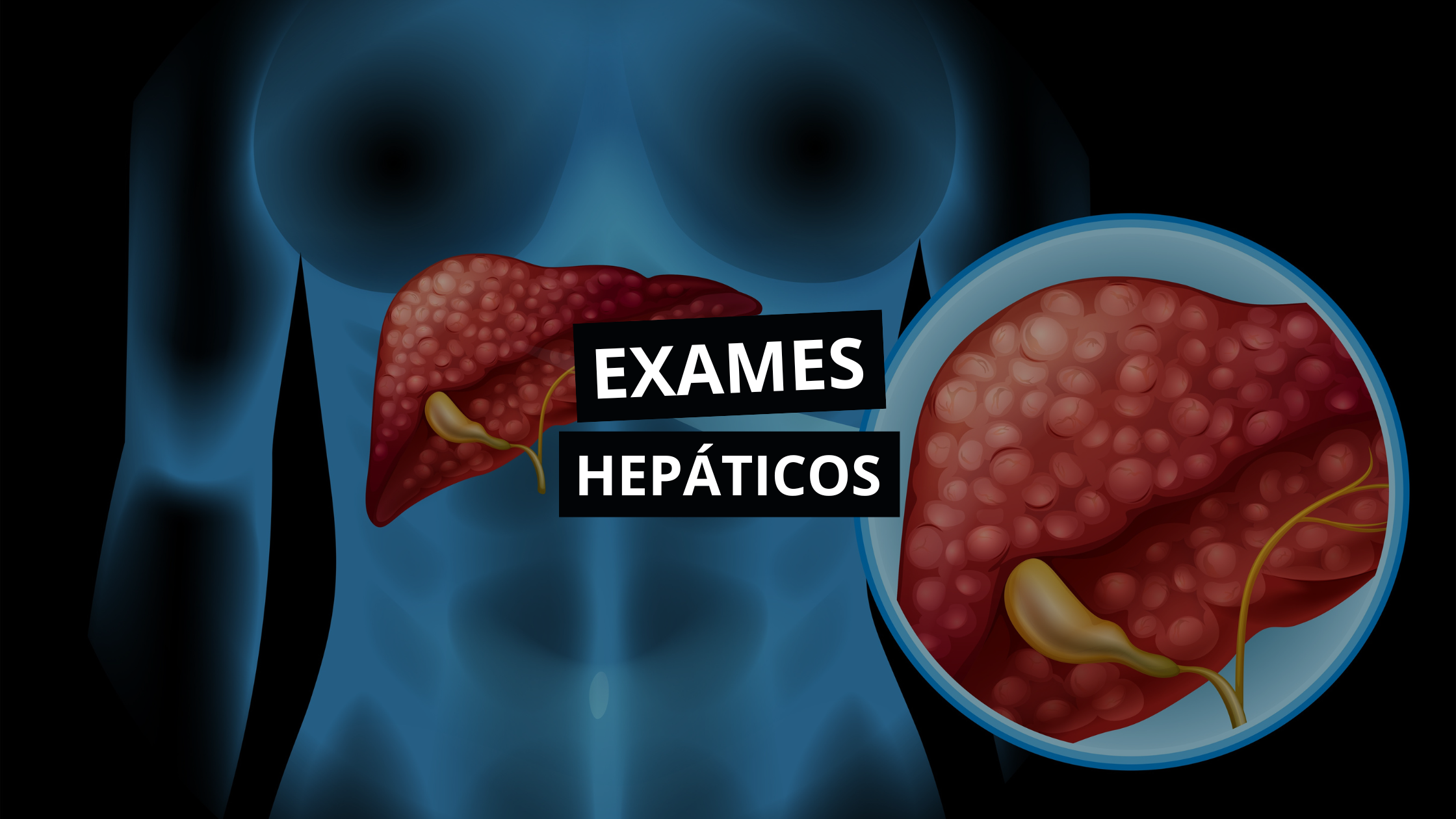 Como interpretar exames hepáticos? - Cursau Educação - Blog